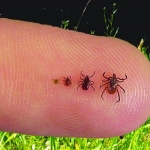 image-589859-thumbs_ticks-on-finger-35-43642e86d01901b42ad2213d05480b4b6bba0b25.jpg